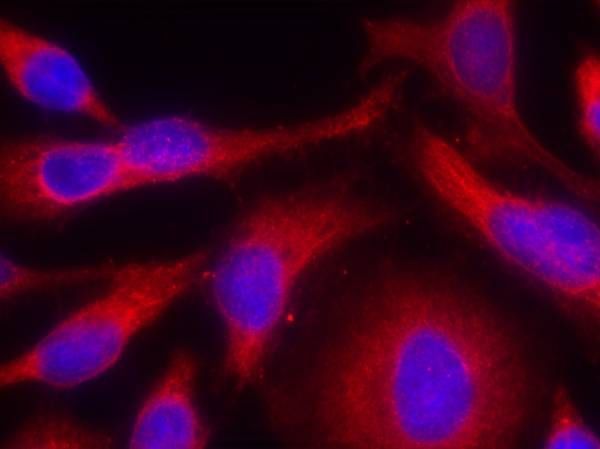 PKD/PKCμ (Phospho-Ser738) Rabbit Polyclonal Antibody, 100 ug
