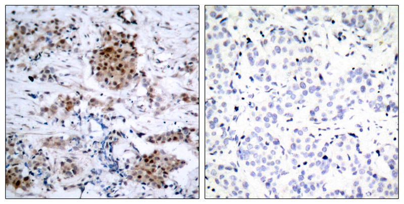 Estrogen Receptor-α (Phospho-Ser167) Rabbit Polyclonal Antibody, 100 ug