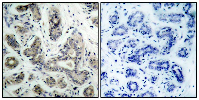BAD (Phospho-Ser136) Rabbit Polyclonal Antibody, 100 ug