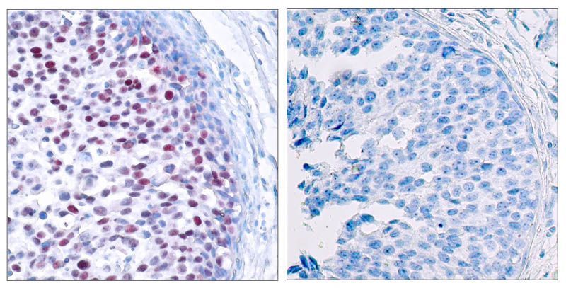 c-Jun (Phospho-Thr239) Rabbit Polyclonal Antibody, 100 ug