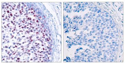 c-Jun (Phospho-Thr239) Rabbit Polyclonal Antibody, 100 ug