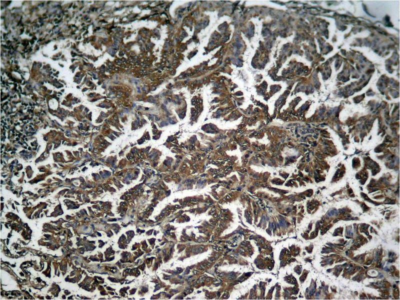 NFκB-p65 (Phospho-Ser536) Rabbit Polyclonal Antibody, 100 ug