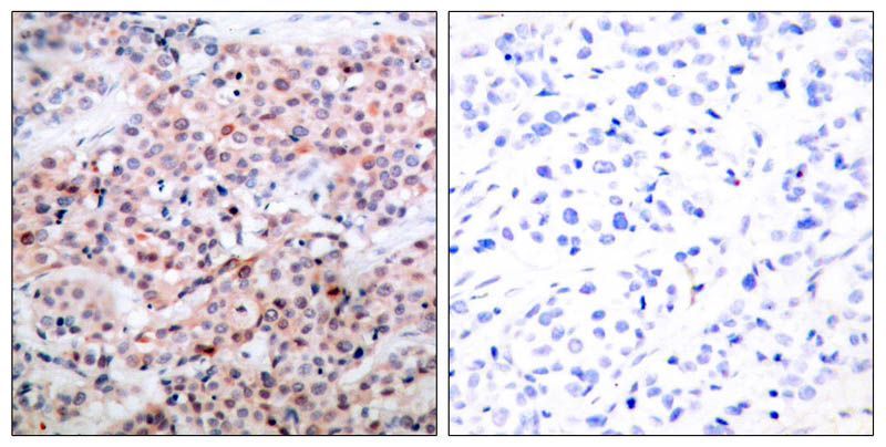 BCL-2(Phospho-Thr56) Rabbit Polyclonal Antibody, 100 ug