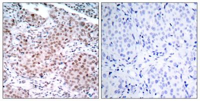 Estrogen Receptor-α (Phospho-Ser104) Rabbit Polyclonal Antibody, 100 ug Estrogen Receptor-α (Phospho-Ser104) Rabbit Polyclonal Antibody, 100 ug