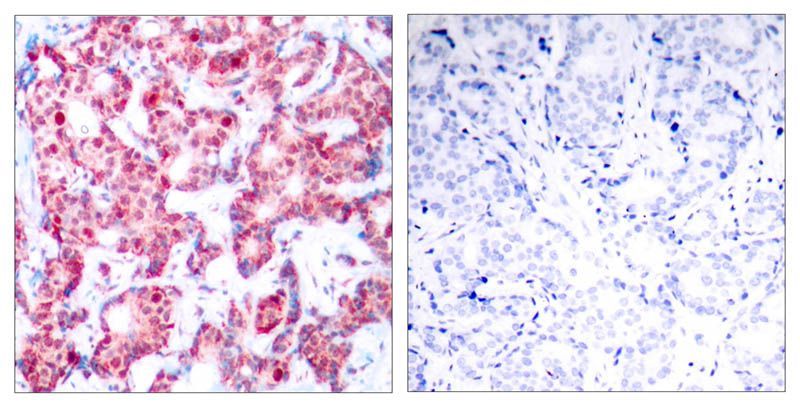 GATA1 (Phospho-Ser142) Rabbit Polyclonal Antibody, 100 ug