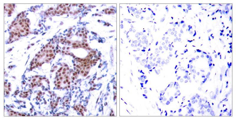 Elk-1 (Phospho-Ser383) Rabbit Polyclonal Antibody, 100 ug