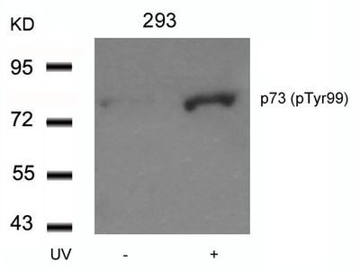 p73 (Phospho-Tyr99) Rabbit Polyclonal Antibody, 100 ug