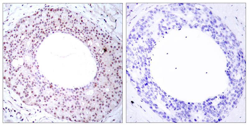 NFκB-p65 (Phospho-Thr254) Rabbit Polyclonal Antibody, 100 ug