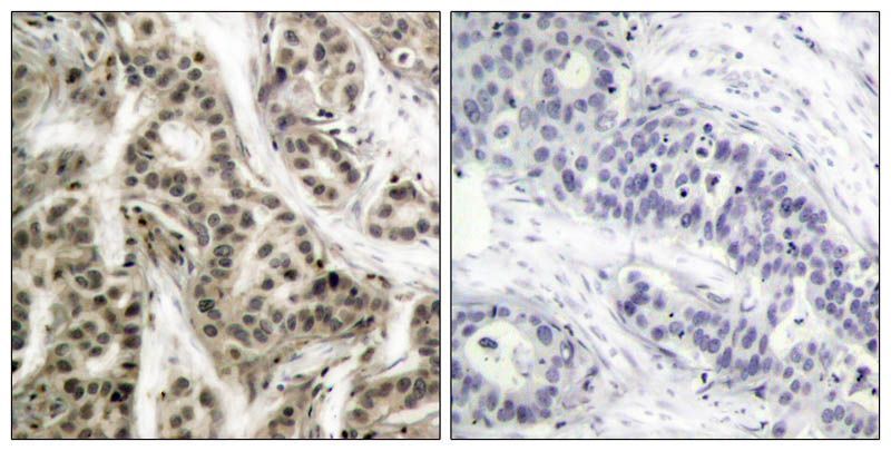 NFκB-p105/p50(Phospho-Ser337) Rabbit Polyclonal Antibody, 100 ug