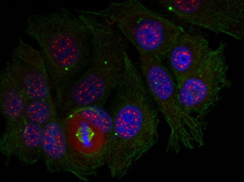 MEF2A (Phospho-Thr319) Rabbit Polyclonal Antibody, 100 ug