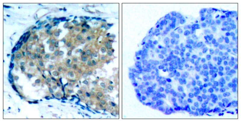 Ezrin (Phospho-Tyr353) Rabbit Polyclonal Antibody, 100 ug