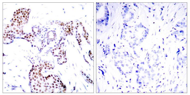 Elk1 (Phospho-Ser389) Rabbit Polyclonal Antibody, 100 ug