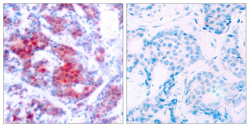 STAT4 (Phospho-Tyr693) Rabbit Polyclonal Antibody, 100 ug
