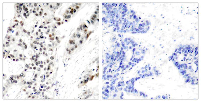 Estrogen Receptor-α (Phospho-Ser106) Rabbit Polyclonal Antibody, 100 ug