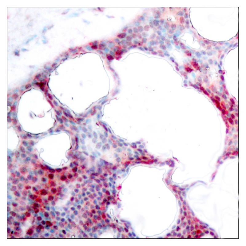 ATF2 (Phospho-Ser62 or 44) Rabbit Polyclonal Antibody, 100 ug