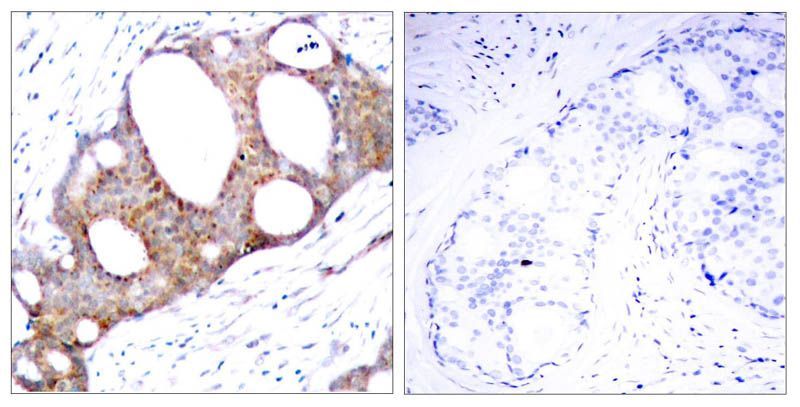 GSK3α (Phospho-Ser21) Rabbit Polyclonal Antibody, 100 ug