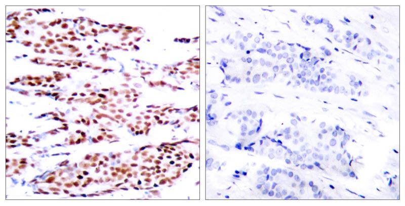 JunB (Phospho-Ser79) Rabbit Polyclonal Antibody, 100 ug