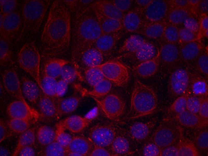 HER2 (Phospho-Tyr1221/Tyr1222) Rabbit Polyclonal Antibody, 100 ug
