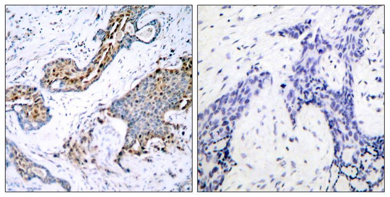 Estrogen Receptor-α (Phospho-Ser118) Rabbit Polyclonal Antibody, 100 ug