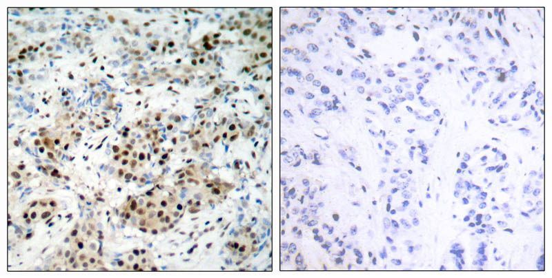 CREB (Phospho-Ser133) Rabbit Polyclonal Antibody, 100 ug