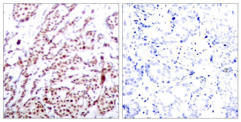 ATF2 (Phospho-Thr73 or 55) Rabbit Polyclonal Antibody, 100 ug