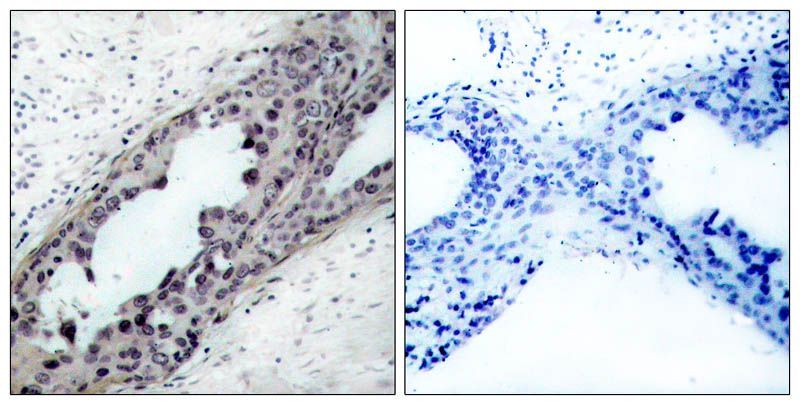 PTEN (Phospho-Ser380/Thr382/Thr383) Rabbit Polyclonal Antibody, 100 ug