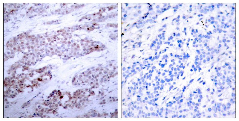 ATF4 (Phospho-Ser245) Rabbit Polyclonal Antibody, 100 ug