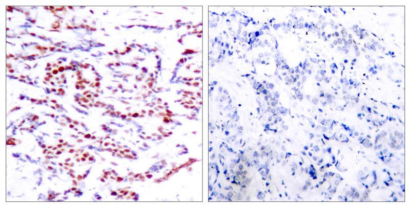 ATF2 (Phospho-Thr71 or 53) Rabbit Polyclonal Antibody, 100 ug