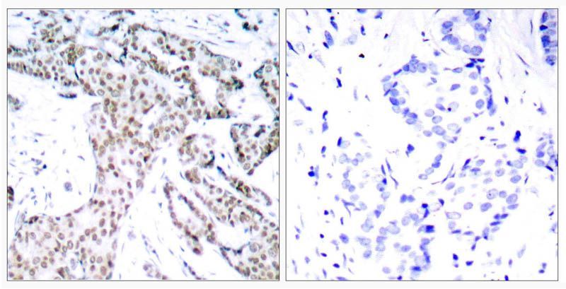 STAT3 (Phospho-Ser727) Rabbit Polyclonal Antibody, 100 ug