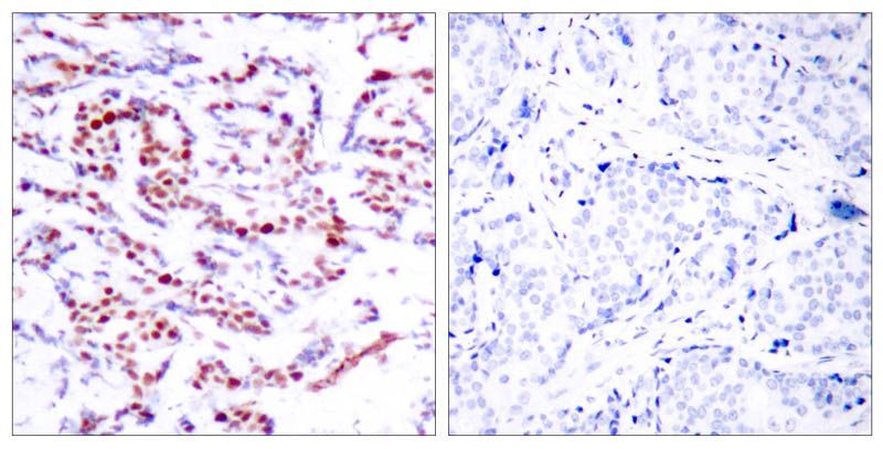 ATF2 (Phospho-Ser112 or 94) Rabbit Polyclonal Antibody, 100 ug