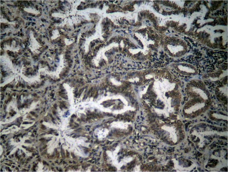 NFκB-p65 (Phospho-Ser276) Rabbit Polyclonal Antibody, 100 ug