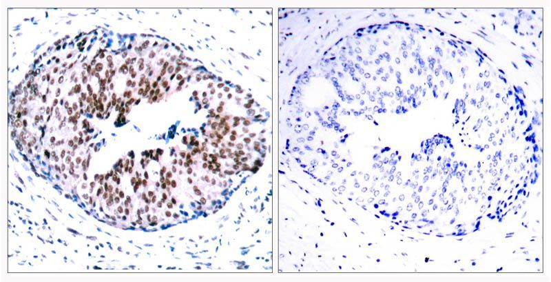 STAT5A (Phospho-Ser780) Rabbit Polyclonal Antibody, 100 ug
