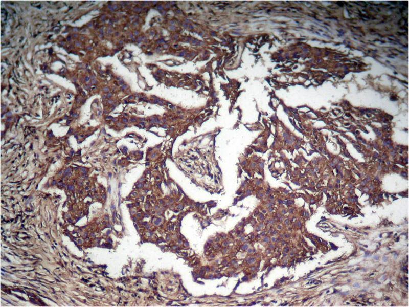 STAT3 (Phospho-Tyr705) Rabbit Polyclonal Antibody, 100 ug