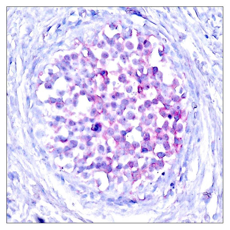 Raf1 (Phospho-Ser259) Rabbit Polyclonal Antibody, 100 ug