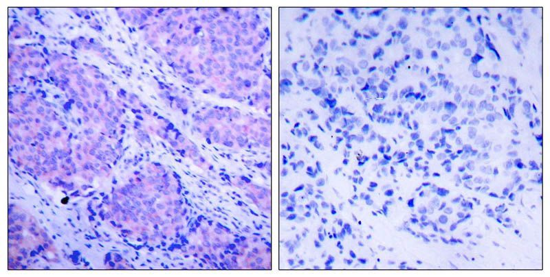 PDK1 (Phospho-Ser241) Rabbit Polyclonal Antibody, 100 ug