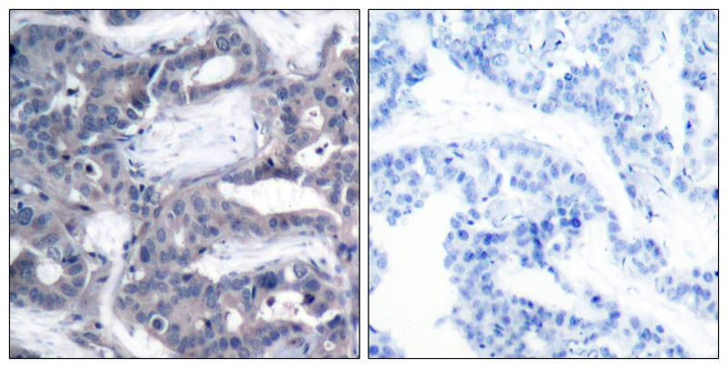 MEK-2 (Phospho-Thr394) Rabbit Polyclonal Antibody, 100 ug