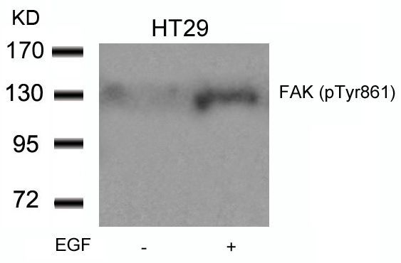 FAK (Phospho-Tyr861) Rabbit Polyclonal Antibody, 100 ug