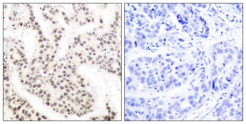 Elk1(Phospho-Thr417) Rabbit Polyclonal Antibody, 100 ug