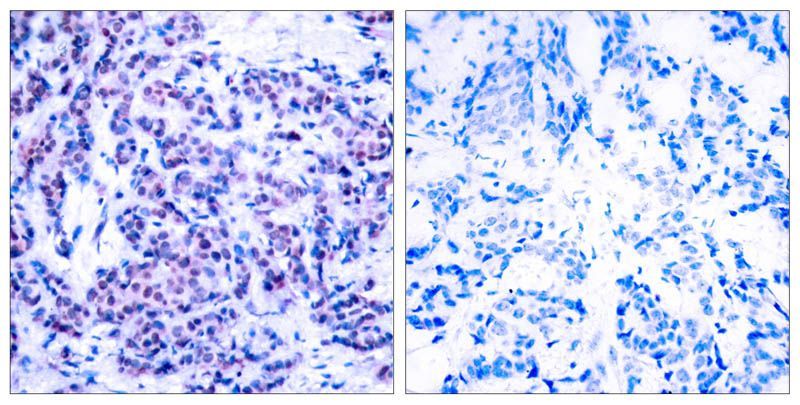 JunD (Phospho-Ser255) Rabbit Polyclonal Antibody, 100 ug