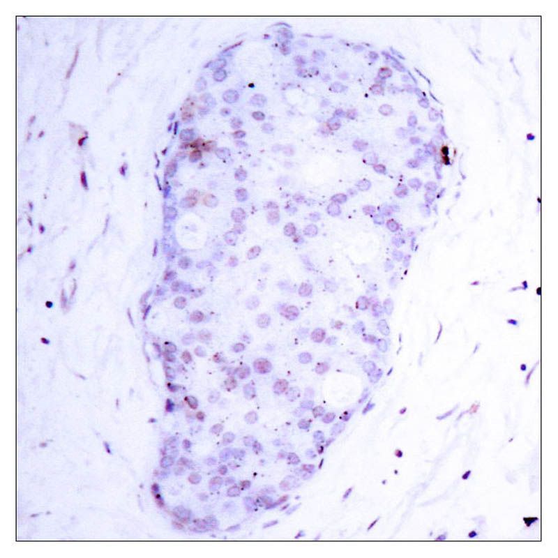 NFκB-p105/p50(Phospho-Ser907) Rabbit Polyclonal Antibody, 100 ug