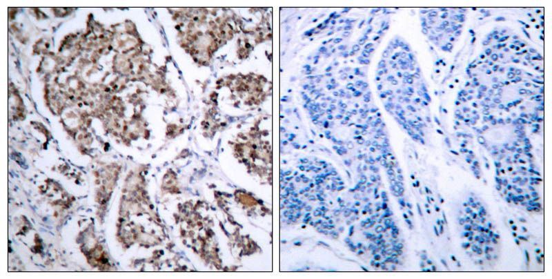 BAD(Phospho-Ser155) Rabbit Polyclonal Antibody, 100 ug