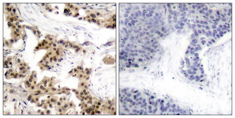 NFκB-p105/p50(Phospho-Ser893) Rabbit Polyclonal Antibody, 100 ug