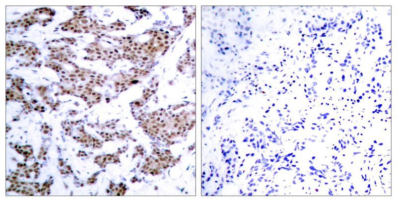 MEF2A (Phospho-Thr312) Rabbit Polyclonal Antibody, 100 ug