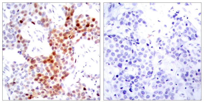 ATF2 (Phospho-Thr69 or 51) Rabbit Polyclonal Antibody, 100 ug