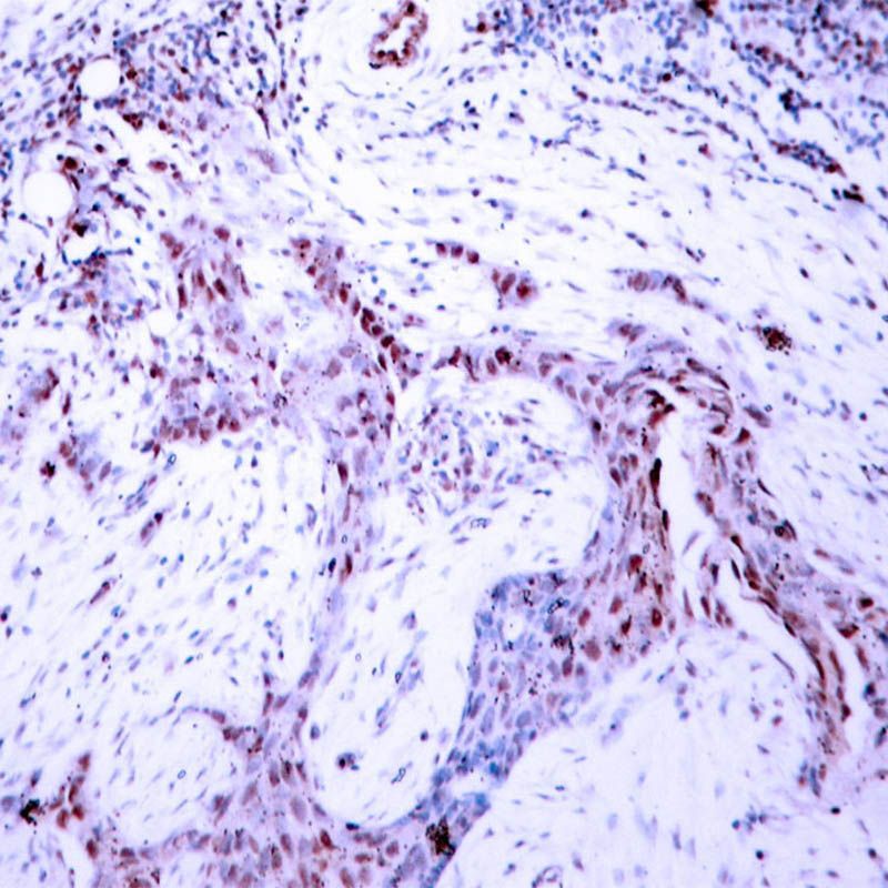 Progesterone Receptor (Phospho-Ser190) Rabbit Polyclonal Antibody, 100 ug