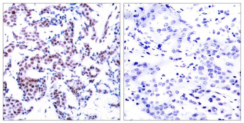 JunB (Phospho-Ser259) Rabbit Polyclonal Antibody, 100 ug