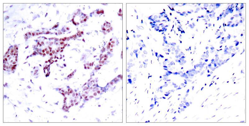 STAT1 (Phospho-Tyr701) Rabbit Polyclonal Antibody, 100 ug