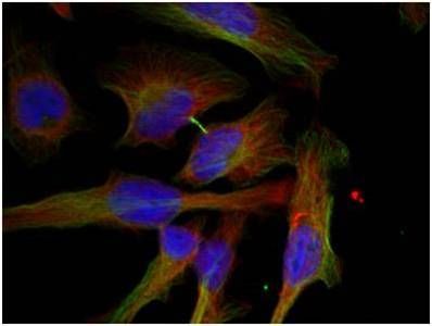 GSK3β (Phospho-Ser9) Rabbit Polyclonal Antibody, 100 ug