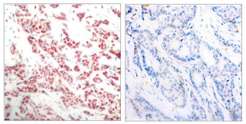 NFκB-p100/p52(Phospho-Ser866) Rabbit Polyclonal Antibody, 100 ug