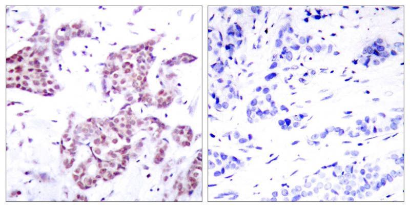 STAT6 (Phospho-Tyr641) Rabbit Polyclonal Antibody, 100 ug